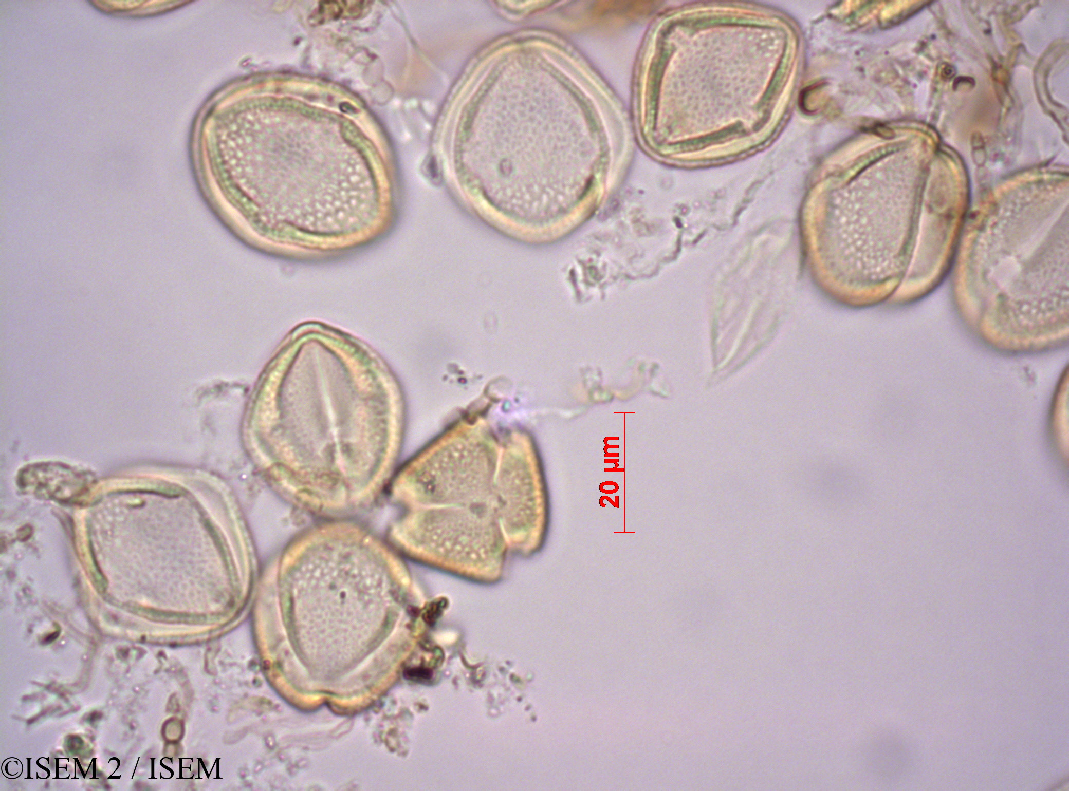 ISEM 2/Cussonia_natalensis_44635/Cussonia_natalensis_44635_0002(copy).jpg